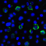 Immunofluorescence of LAG-3 in over expressing HEK293 cells using LAG-3 Antibody at 2 μg/ml. <br><br>Green: LAG3 Antibody [6D1] (RF16087) <br> Blue: DAPI staining