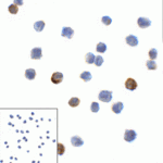 Immunocytochemistry of LAG-3 in over expressing HEK293 cells using LAG-3 antibody and control mouse IgG antibody (left corner box) at 1 μg/ml.