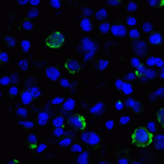 Immunofluorescence of LAG-3 in over expressing HEK293 cells using LAG-3 Antibody at 2 μg/ml.