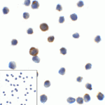 Immunocytochemistry of LAG-3 in over expressing HEK293 cells using LAG-3 antibody and control mouse IgG antibody (left corner box) at 1 μg/ml.