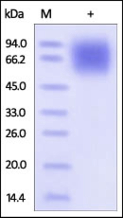 LAMP1 Recombinant Protein
