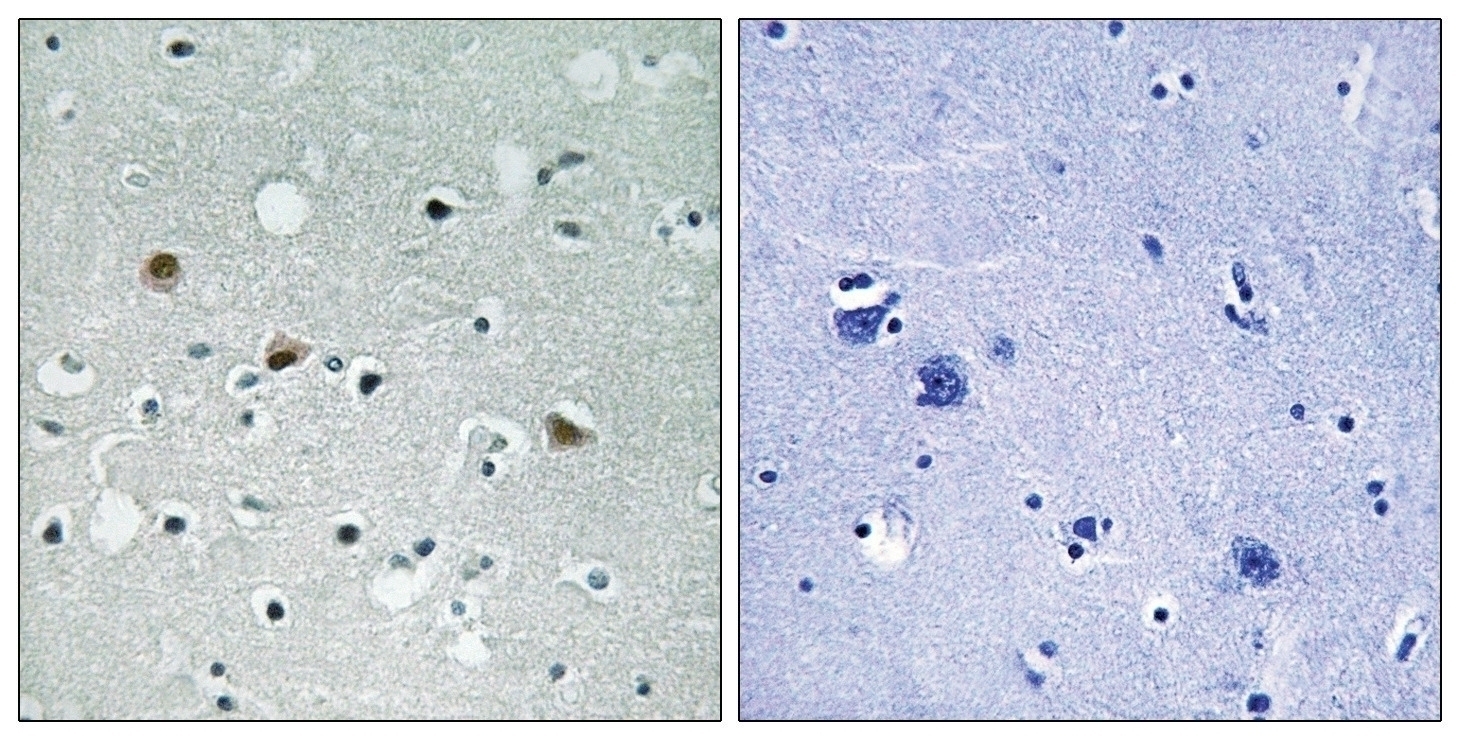 LATS1/2 (phospho Thr1079/1041) Antibody