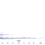 To detect Human LD78-beta by Western Blot analysis this antibody can be used at a concentration of 0.1- 0.2 ug/ml. When used in conjunction with compatible secondary reagents, the detection limit for recombinant Human LD78-beta is 1.5-3.0 ng/lane, under either reducing or non-reducing conditions.