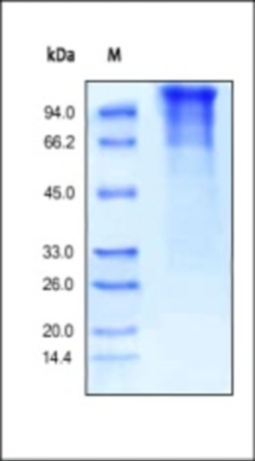 LDLR Recombinant Protein