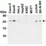 <strong>Figure 2 Western Blot Validation in Human Cell Lines</strong><br>Loading: 15 μg of lysates per lane.Antibodies: LIF 6245, (1 μg/mL), 1h incubation at RT in 5% NFDM/TBST.Secondary: Goat anti-rabbit IgG HRP conjugate at 1:10000 dilution.