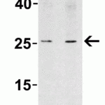 <strong>Figure 5 Western Blot Validation in Rat Lung</strong><br>Loading: 15 μg of lysates per lane.Antibodies: LIF 6245, (1: 1 μg/mL, 2: 2 μg/mL), 1h incubation at RT in 5% NFDM/TBST.Secondary: Goat anti-rabbit IgG HRP conjugate at 1:10000 dilution.