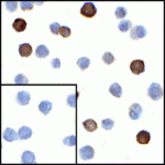 Immunocytochemistry of LIGHT in transfected HEK293 cells with LIGHT antibody at 1 μg/mL. Lower left: Immunocytochemistry in transfected HEK293 cells with control mouse IgG antibody at 1 μg/mL.