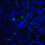 Immunofluorescence of LIGHT in human lymphoma tissue with LIGHT antibody at 20 μg/mL. <br><br>Green: LIGHT Antibody [7B9E12] (RF16063) <br> Blue: DAPI staining