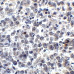 Immunohistochemistry of LIGHT in human lymphoma tissue with LIGHT antibody at 5 μg/mL.