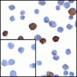 Immunocytochemistry of LIGHT in transfected HEK293 cells with LIGHT antibody at 1 μg/mL. Lower left: Immunocytochemistry in transfected HEK293 cells with control mouse IgG antibody at 1 μg/mL.