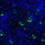 Immunofluorescence of LIGHT in human lymphoma tissue with LIGHT antibody at 20 μg/mL. <br><br>Green: LIGHT Antibody [7B9F12] (RF16061) <br> Blue: DAPI staining