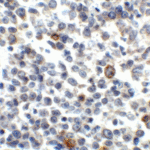 Immunohistochemistry of LIGHT in human lymphoma tissue with LIGHT antibody at 5 μg/mL.