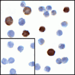 Immunocytochemistry of LIGHT in transfected HEK293 cells with LIGHT antibody at 1 μg/mL. Lower left: Immunocytochemistry in transfected HEK293 cells with control mouse IgG antibody at 1 μg/mL.