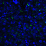 Immunofluorescence of LIGHT in human lymphoma tissue with LIGHT antibody at 20 μg/mL. <br><br>Green: LIGHT Antibody [7B9H9] (RF16062) <br> Blue: DAPI staining