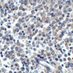 Immunohistochemistry of LIGHT in human lymphoma tissue with LIGHT antibody at 5 μg/mL.