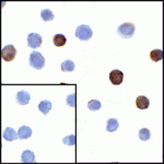 Immunocytochemistry of LIGHT in transfected HEK293 cells with LIGHT antibody at 1 μg/mL. Lower left: Immunocytochemistry in transfected HEK293 cells with control mouse IgG antibody at 1 μg/mL.