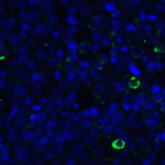 Immunofluorescence of LIGHT in human lymphoma tissue with LIGHT antibody at 20 μg/mL. <br><br>Green: LIGHT Antibody [8D4] (RF16064) <br> Blue: DAPI staining