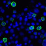 Immunofluorescence of LIGHT in transfected HEK293 cells with LIGHT antibody at 2 μg/mL. <br><br>Green: LIGHT Antibody [8D4] (RF16064) <br> Blue: DAPI staining