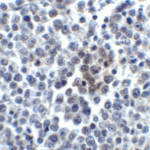 Immunohistochemistry of LIGHT in human lymphoma tissue with LIGHT antibody at 5 μg/mL.