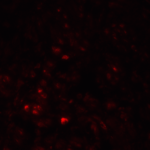 Immunofluorescence of LRRC26 in human prostate tissue with LRRC26 Antibody at 20 μg/mL.