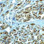 Immunohistochemistry of LRRC26 in human prostate tissue with LRRC26 antibody at 2.5 μg/ml.