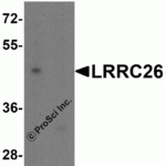 Western blot analysis of LRRC26 in Jurkat cell lysate with LRRC26 antibody at 0.5 μg/ml in (A) the absence and (B) the presence of blocking peptide.