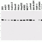 <strong>Figure 1 Western Blot Validation in Cell Lines</strong><br>Loading: 15 μg of lysates per lane.Antibodies: LSD1 3761 (0.2 μg/mL), 1h incubation at RT in 5% NFDM/TBST.Secondary: Goat anti-rabbit IgG HRP conjugate at 1:10000 dilution.