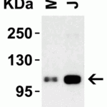 <strong>Figure 1 Western Blot Validation in Human Cell Lines</strong><br>Loading: 15 μg of lysates per lane.Antibodies: LSD1 3763 ( 1 μg/mL), 1h incubation at RT in 5% NFDM/TBST.Secondary: Goat anti-rabbit IgG HRP conjugate at 1:10000 dilution.