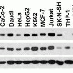 <strong>Figure 2 Independent Antibody Validation (IAV) via Protein Expression Profile in Cell Lines</strong><br>Loading: 15 μg of lysates per lane.Antibodies: LSD1 3761 (0.2 μg/mL), LSD1 14-050 (1 μg/mL), beta-actin 3779 (1 μg/mL),  1h incubation at RT  in 5% NFDM/TBST.Secondary: Goat anti-rabbit IgG HRP conjugate at 1:10000 dilution.