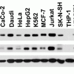 <strong>Figure 2 Independent Antibody Validation (IAV) via Protein Expression Profile in Cell Lines</strong><br>Loading: 15 μg of lysates per lane.Antibodies: LSD1 3761 (0.2 μg/mL), LSD1 3763 (1 μg/mL),  beta-actin 3779 (1 μg/mL),  1h incubation at RT  in 5% NFDM/TBST.Secondary: Goat anti-rabbit IgG HRP conjugate at 1:10000 dilution.