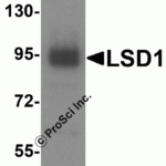 <strong>Figure 2 Western Blot Validation in Human A549 Cell Line</strong><br>Loading: 15μg  of lysates per lane.Antibodies: LSD1 8223 (1 µg/mL), 1h incubation at RT in 5% NFDM/TBST.Secondary: Goat anti-rabbit IgG HRP conjugate at 1:10000 dilution.