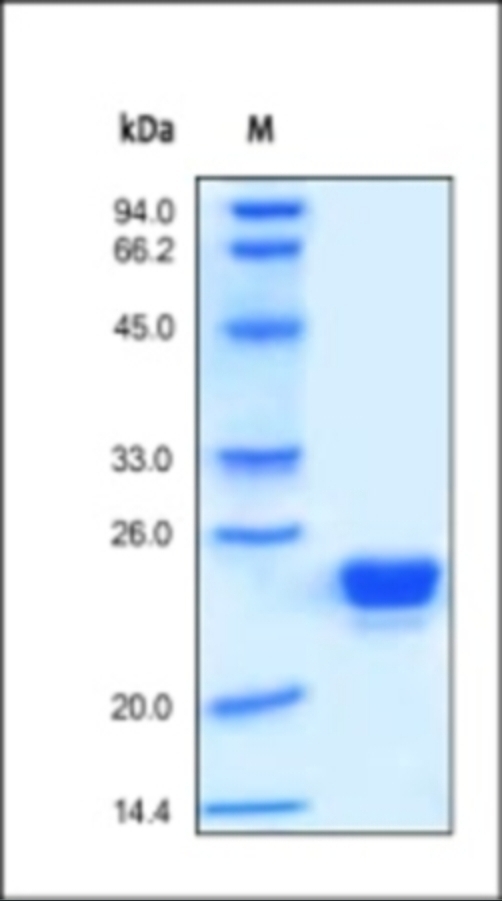 Lipocalin 2 Recombinant Protein
