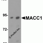 Western blot analysis of MACC1 expression in human liver tissue lysate with MACC1 antibody at (A) 1 and (B) 2 μg/ml.