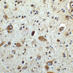<strong>Figure 12  Immunohistochemistry Validation of MANF in Human Brain Tissue </strong><br> Immunohistochemical analysis of paraffin-embedded human brain tissue using anti-MANF antibody (4347) at 2.5 μg /ml. Tissue was fixed with formaldehyde and blocked with 10% serum for 1 h at RT; antigen retrieval was by heat mediation with a citrate buffer (pH6). Samples were incubated with primary antibody overnight at 4°C. A goat anti-rabbit IgG H&L (HRP) at 1/250 was used as secondary. Counter stained with Hematoxylin.