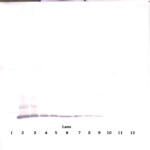 To detect hMCP-2 by Western Blot analysis this antibody can be used at a concentration of 0.1-0.2 ug/ml. Used in conjunction with compatible secondary reagents the detection limit for recombinant hMCP-2 is 1.5-3.0 ng/lane, under either reducing or non-reducing conditions.