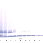 To detect mMCP-5 by Western Blot analysis this antibody can be used at a concentration of 0.1-0.2 ug/ml. Used in conjunction with compatible secondary reagents the detection limit for recombinant mMCP-5 is 1.5-3.0 ng/lane, under either reducing or non-reducing conditions.