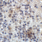 Immunohistochemistry of MD-2 in human spleen with MD-2 Antibody at 2 μg/ml.