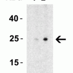 <strong>Figure 5 Western Blot Validation in Rat Spleen Tissue Lysate</strong><br>Loading: 15 μg of lysates per lane.Antibodies: MD-2, 3289 (Lane 1: 0.5 μg/mL and Lane 2: 1 μg/mL), 1h incubation at RT in 5% NFDM/TBST.Secondary: Goat anti-rabbit IgG HRP conjugate at 1:10000 dilution.