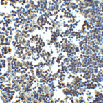 <strong>Figure 3 Immunohistochemistry Validation of MDA5 in Human Lymph Node</strong><br> Immunohistochemical analysis of paraffin-embedded human lymph node tissue using anti-MDA5 antibody (4037) at 2.5 μg/ml. Tissue was fixed with formaldehyde and blocked with 10% serum for 1 h at RT; antigen retrieval was by heat mediation with a citrate buffer (pH6). Samples were incubated with primary antibody overnight at 4°C. A goat anti-rabbit IgG H&L (HRP) at 1/250 was used as secondary. Counter stained with Hematoxylin.