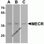 Western blot analysis of MECR in (A) human brain tissue, (B) mouse brain tissue, and (C) rat brain tissue lysate with MECR antibody at 1 μg/mL.