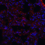 Immunofluorescence of MFSD2A in mouse lung tissue with MFSD2A antibody at 20 μg/mL.<br><br>Red: MFSD2A Antibody (6025) <br> Blue: DAPI staining