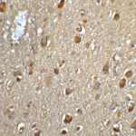 Immunohistochemistry of MFSD2A in human brain tissue with MFSD2A antibody at 5 μg/mL.