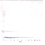 To detect hMIA by Western Blot analysis this antibody can be used at a concentration of 0.1 - 0.2 ug/ml. Used in conjunction with compatible secondary reagents the detection limit for recombinant hMIA is 1.5 - 3.0 ng/lane, under either reducing or non-reducing conditions.