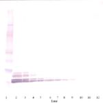 To detect Human MIP-1-alpha by Western Blot analysis this antibody can be used at a concentration of 0.1-0.2 ug/ml. When used in conjunction with compatible secondary reagents, the detection limit for recombinant Human MIP-1-alpha is 1.5-3.0 ng/lane, under either reducing or non-reducing conditions.
