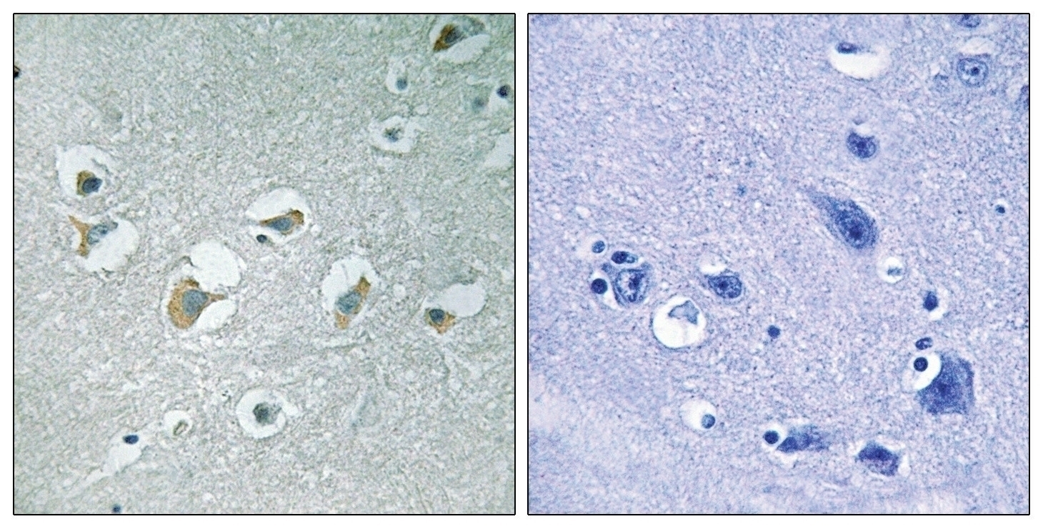 MLK1/2 (phospho Thr312/266) Antibody