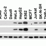 <strong>Figure 1 Independent Antibody Validation (IAV) via Protein Expression Profile in Human Cell Lines</strong><br>Loading: 15 μg of lysates per lane.Antibodies: MPYS 5269 (1 μg/mL), MPYS 64-236 (2 μg/mL) and beta-actin 3779 (1 μg/mL),  1h incubation at RT  in 5% NFDM/TBST.Secondary: Goat anti-rabbit IgG HRP conjugate at 1:10000 dilution.