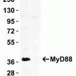 <strong>Figure 1 KO Validation in HeLa Cells</strong><br> Loading: 10 μg of HeLa WT cell lysate or MyD88 KO cell lysate. Antibodies:  MyD88 2127 (2 μg/mL) and beta-actin 3779 (1 μg/mL), 1 h incubation at RT in 5% NFDM/TBST.Secondary: Goat Anti-Rabbit IgG HRP conjugate at 1:10000 dilution.