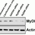 <strong>Figure 12 KD Validation in Raw 264.7 cells (Altimeier et al., 2007) </strong><br>The Transfection of RAW 264.7 cells with MyD88-specific siRNAresulted in attenuation of MyD88 protein by Western blot analysis with anti-Myd88 antibodies (2127).