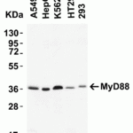 <strong>Figure 3 Western Blot Validation of MyD88 in human cell lines</strong><br>Loading: 15 μg of lysates per lane.Antibodies: 2127 (2 μg/mL) 1 h incubation at RT in 5% NFDM/TBST.Secondary: Goat anti-rabbit IgG HRP conjugate at 1:10000 dilution.Predicted band size: 35 kDa
