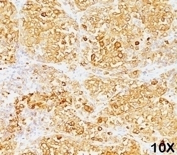 Melan-A Antibody [M2-9E3]